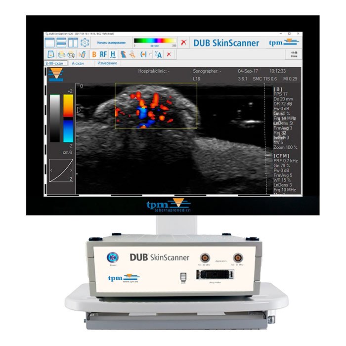 Аппарат для ультразвукового исследования кожи dub skinscanner (аппарат для определения морфофункциональных параметров кожи), германия